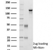 SDS-PAGE analysis of purified, BSA-free recombinant AR antibody (clone rDHTR/6818) as confirmation of integrity and purity.