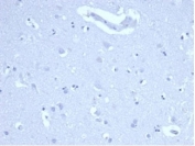 Negative control: IHC staining of FFPE human brain tissue using recombinant Ki67 antibody (clone MKI67/4947R) at 2ug/ml in PBS for 30min RT. HIER: boil tissue sections in pH 9 10mM Tris with 1mM EDTA for 20 min and allow to cool before testing.