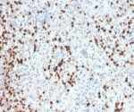 Myeloperoxidase Antibody Rabbit Monoclonal MPO/33R / MPO Antibody. Immunohistochemistry analysis of Myeloperoxidase Antibody Rabbit Monoclonal MPO/33R in FFPE human spleen tissue. Brown chromogenic staining identifies cytoplasmic Myeloperoxidase / MPO-positive myeloid cells distributed throughout the splenic tissue. Heat-induced epitope retrieval was performed by boiling tissue sections in pH 9 10mM Tris with 1mM EDTA for 20 minutes followed by cooling prior to staining.