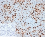 IHC staining of FFPE human spleen tissue with recombinant Myeloperoxidase antibody (clone MPO/33R). Negative control inset: PBS instead of primary antibody to control for secondary binding. HIER: boil tissue sections in pH 9 10mM Tris with 1mM EDTA for 20 min and allow to cool before testing.