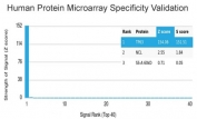 p63 Antibody Microarray Specificity Validated Clone TP63/4379R. Protein microarray analysis using a HuProt(TM) array containing more than 19,000 full-length human proteins demonstrates highly selective binding of recombinant rabbit monoclonal clone TP63/4379R to Tumor protein 63 (TP63). The antibody shows a dominant top-ranked signal for TP63 with a very high Z-score and strong separation from all other proteins, indicating robust target recognition with minimal off-target interaction. Signals for non-target proteins are negligible, supporting a clean specificity profile across the proteome. Z-score reflects signal intensity relative to the array mean, while S-score represents the separation between the TP63 signal and the next highest-ranking proteins, confirming clear discrimination of the intended target. These results support the use of this p63 antibody for applications requiring high specificity and confident interpretation of TP63 detection.