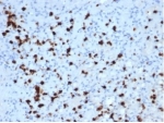 IHC analysis of Myeloperoxidase/MPO antibody in human bone marrow tissue. Formalin-fixed, paraffin-embedded human bone marrow shows HRP-DAB brown granular cytoplasmic staining in myeloid lineage cells using Myeloperoxidase/MPO antibody (clone MPO/7118). Hematoxylin counterstain highlights nuclei in blue. Heat induced epitope retrieval was performed by boiling tissue sections in pH 9 10mM Tris with 1mM EDTA for 20 minutes followed by cooling prior to staining.
