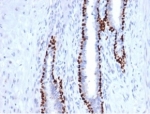 deltaNp63 Antibody. Immunohistochemistry analysis of FFPE human prostate tissue demonstrates strong HRP-DAB brown nuclear staining in basal epithelial cells outlining glandular structures, while luminal secretory cells remain negative. The nuclear-restricted pattern highlights epithelial cell populations and supports use of this antibody as an epithelial identity regulator, with deltaNp63 expression reflecting TP63-driven maintenance of epithelial lineage. Staining is crisp with minimal background, allowing clear visualization of gland architecture and basal cell compartmentalization. Heat-induced epitope retrieval was performed by boiling tissue sections in pH 9 10mM Tris with 1mM EDTA for 20 minutes followed by cooling prior to antibody incubation.