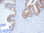 Pan Cytokeratin Antibody human prostate IHC. Immunohistochemistry analysis of cytokeratin expression in FFPE human prostate tissue using Pan Cytokeratin antibody clone PCK/4933R. Strong cytoplasmic HRP-DAB brown staining highlights epithelial cells lining glandular structures, demonstrating broad and uniform epithelial coverage, while surrounding stromal tissue remains negative. The staining pattern supports reliable identification of epithelial compartments across tissue regions. Negative control inset shows PBS used in place of primary antibody to confirm specificity of staining. HIER was performed by boiling tissue sections in pH 9 10 mM Tris with 1 mM EDTA for 20 minutes followed by cooling prior to antibody incubation.