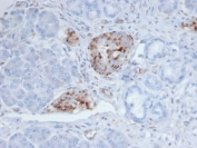 Chromogranin A Antibody Protein Microarray Validated Pancreas IHC. Immunohistochemistry staining of formalin-fixed, paraffin-embedded human pancreatic tissue with Chromogranin A antibody (clone CHGA/4219) shows cytoplasmic granular staining within islets of Langerhans, consistent with CHGA expression in pancreatic neuroendocrine cells, while surrounding exocrine acinar structures are largely negative. Heat-induced epitope retrieval was performed by boiling sections in pH 9 10mM Tris with 1mM EDTA for 20 minutes followed by cooling prior to testing.