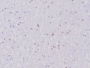 OLIG2 Antibody Cerebellum IHC. Immunohistochemical analysis of Oligodendrocyte transcription factor 2 (OLIG2) in formalin-fixed, paraffin-embedded human cerebellum tissue using OLIG2 antibody clone OLIG2/6695R. Scattered nuclear staining is observed in glial cells within the cerebellar parenchyma, consistent with OLIG2 expression in oligodendrocyte lineage cells. The distribution of positive nuclei reflects normal glial cell populations in brain tissue. Required HIER: boil tissue sections in pH 9 10mM Tris with 1mM EDTA for 20 min and allow to cool before testing.