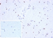 OLIG2 Antibody Brain IHC. Immunohistochemical analysis of Oligodendrocyte transcription factor 2 (OLIG2) in formalin-fixed, paraffin-embedded human brain tissue using OLIG2 antibody clone OLIG2/6695R. Scattered nuclear staining is observed in glial cells within the brain parenchyma, consistent with OLIG2 expression in oligodendrocyte lineage cells. The distribution of positive nuclei reflects normal neural tissue architecture. The antibody was applied at 2 ug/ml in PBS for 30 min at room temperature. Inset: PBS used in place of primary antibody serves as a negative control for secondary antibody binding. Required HIER: boil tissue sections in pH 9 10mM Tris with 1mM EDTA for 20 min and allow to cool before testing.
