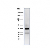 APO-J Antibody Testis WB. Western blot analysis of human testis lysate using APO-J antibody. The mouse monoclonal antibody clone CLU/4723 detects bands at approximately 75-80 kDa and lower molecular weight bands around 34-39 kDa, consistent with the predicted molecular weight of full-length Clusterin / APO-J and its processed alpha and beta subunits. This banding pattern reflects proteolytic cleavage and glycosylation of this secreted chaperone protein, supporting its role in lipid transport and extracellular protein stabilization in western blot analysis.