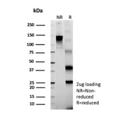 SDS-PAGE analysis of purified, BSA-free recombinant TP63 Antibody / Squamous Cell Marker Antibody (clone rTP63/6941) as confirmation of integrity and purity.