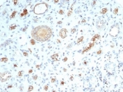 CFTR Antibody for IHC Kidney. Immunohistochemistry analysis of Cystic fibrosis transmembrane conductance regulator / CFTR expression in FFPE human kidney tissue using recombinant rabbit monoclonal antibody clone CFTR/7003R. This CFTR antibody shows apical membranous HRP-DAB brown staining in renal tubular epithelial cells, with luminal accentuation and minimal signal in surrounding stromal elements; nuclei are counterstained blue. The staining pattern is consistent with polarized epithelial localization of CFTR in kidney tubules. Antigen retrieval was performed by boiling sections in 10 mM Tris buffer with 1 mM EDTA, pH 9, for 20 min followed by cooling at room temperature.