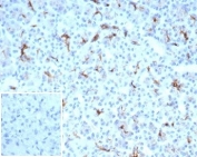 CFTR Antibody for IHC Pancreas. Immunohistochemistry analysis of Cystic fibrosis transmembrane conductance regulator / CFTR expression in FFPE human pancreatic tissue using recombinant rabbit monoclonal antibody clone CFTR/7003R. This CFTR antibody shows apical membranous HRP-DAB brown staining in pancreatic ductal epithelial cells, with minimal signal in surrounding acinar and stromal compartments; nuclei are counterstained blue. The staining pattern reflects polarized epithelial localization consistent with pancreatic duct structures. Inset shows a PBS-only negative control processed without primary antibody, confirming minimal non-specific background staining. Antigen retrieval was performed by boiling sections in 10 mM Tris buffer with 1 mM EDTA, pH 9, for 20 min followed by cooling at room temperature.