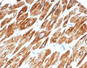 Desmin Antibody Cardiac Muscle IHC. Immunohistochemistry staining of FFPE human cardiac muscle tissue using Desmin antibody (clone DES/3255) demonstrates strong, diffuse cytoplasmic staining throughout cardiomyocytes, consistent with the abundant expression of Desmin intermediate filaments within cardiac muscle. Desmin is a type III intermediate filament protein that forms an essential component of the muscle cytoskeleton, providing structural support and helping maintain the organization of contractile elements within muscle cells. The widespread staining observed in cardiac muscle fibers is consistent with the established role of Desmin as a highly sensitive marker of muscle differentiation and muscle lineage identification. HIER: boil tissue sections in pH 9 10mM Tris with 1mM EDTA for 20 min and allow to cool before testing.