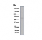 ESR1 Antibody MCF7 Cell WB. Western blot testing of human MCF-7 cell lysate using recombinant ESR1 antibody (clone ESR1/6983R).