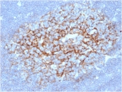 CD23 Antibody Germinal Center Lymph Node IHC. Immunohistochemistry staining of FFPE human lymph node with CD23 antibody (clone FCER2/6891) at 2ug/ml in PBS for 30min RT. HIER: boil tissue sections in pH 9 10mM Tris with 1mM EDTA for 20 min and allow to cool before testing.