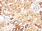 Recombinant Aldose reductase Antibody Kidney IHC. Immunohistochemistry staining of FFPE human kidney tissue with recombinant Aldose reductase antibody (clone AKR1B1/7009R). HIER: boil tissue sections in pH 9 10mM Tris with 1mM EDTA for 20 min and allow to cool before testing.