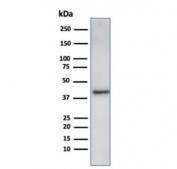 Recombinant Filaggrin Antibody A431 WB. Western blot analysis of human A431 cell lysate using recombinant Filaggrin antibody (clone FLG/3909R). Expected molecular weight: ~434 kDa (precursor); 37-45 kDa (processed).