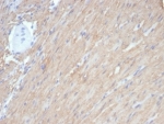 CALD1 Antibody / Caldesmon Gene Expression Regulatory Protein Antibody. Immunohistochemistry analysis of Caldesmon (CALD1) in human smooth muscle tissue. FFPE human smooth muscle stained with CALD1 Antibody, clone rCALD1/7266, demonstrates strong HRP-DAB brown cytoplasmic staining in elongated smooth muscle cells. The staining highlights uniform, organized cellular architecture consistent with transcriptionally regulated expression of CALD1 in differentiated cell populations. The consistent cytoplasmic signal across aligned muscle fibers supports its association with gene expression programs linked to stable cellular phenotype. Heat-induced epitope retrieval was performed using Tris-EDTA buffer at pH 9.