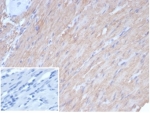 CALD1 Antibody / Caldesmon Gene Expression Regulatory Protein Antibody. Immunohistochemistry analysis of Caldesmon (CALD1) in human smooth muscle tissue. FFPE human smooth muscle stained with CALD1 Antibody, clone rCALD1/7266, demonstrates strong HRP-DAB brown cytoplasmic staining in elongated smooth muscle cells arranged in parallel bundles. The uniform staining pattern is consistent with transcriptionally regulated CALD1 expression in differentiated cell populations. Inset: negative control using PBS in place of the primary antibody shows absence of brown signal, confirming specificity of staining. Heat-induced epitope retrieval was performed using Tris-EDTA buffer at pH 9.