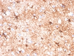 Glial Fibrillary Acidic Protein Antibody Human Cerebellum Tissue IHC. Immunohistochemistry staining of FFPE human cerebellum tissue with Glial Fibrillary Acidic Protein antibody (clone GFAP/4450). HIER: boil tissue sections in pH 9 10mM Tris with 1mM EDTA for 20 min and allow to cool before testing.