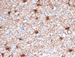 Glial Fibrillary Acidic Protein Antibody Cerebellum Immunohistochemistry. IHC staining of FFPE human cerebellum tissue with Glial Fibrillary Acidic Protein antibody (clone GFAP/4450). HIER: boil tissue sections in pH 9 10mM Tris with 1mM EDTA for 20 min and allow to cool before testing.