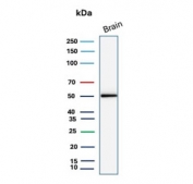 Glial Fibrillary Acidic Protein Antibody Brain WB. Western blot testing of human brain tissue lysate with Glial Fibrillary Acidic Protein antibody. Predicted molecular weight ~50 kDa.
