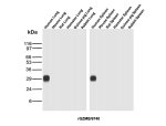 Recombinant GZMB Antibody in Multi-Species Lung and Spleen WB. Western blot testing of Recombinant GZMB Antibody / Granzyme B in lung and spleen tissue lysates from human, mouse, rat, hamster, guinea pig and rabbit. A strong band is observed at approximately 29 kDa in human lung and human spleen, while no corresponding band is detected in the tested mouse, rat, hamster, guinea pig or rabbit tissues. This Recombinant GZMB Antibody demonstrates detection of endogenous Granzyme B in the tested human tissues.