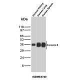 Recombinant GZMB Antibody in Human Kidney, Lung and Spleen WB. Western blot testing of Recombinant GZMB Antibody / Granzyme B in human kidney, lung and spleen tissue lysates. Granzyme B is detected as a prominent band at approximately 35-36 kDa in all three tissues, with the strongest signal observed in spleen. This Recombinant GZMB Antibody demonstrates detection of endogenous Granzyme B across the tested human tissues.