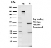SDS-PAGE analysis of purified, BSA-free Haptoglobin antibody (clone HP/3840) as confirmation of integrity and purity.