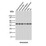 40S Ribosomal protein SA Antibody RPSA/6332R in Human Sample WB. Western Blot Analysis of Human Pancreas, Human Skin, Human Spleen, Human Stomach, HeLa and 3T3 lysates using Laminin Receptor 1 Recombinant Antibody (clone RPSA/6332R).