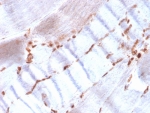 Immunohistochemistry analysis of Actin / ACTA2 antibody (clone ACTA2/1614R) in human skeletal muscle tissue. FFPE human skeletal muscle shows cytoplasmic HRP-DAB brown staining predominantly within smooth muscle elements associated with vascular structures, consistent with Alpha smooth muscle actin expression. Staining highlights vascular smooth muscle cells and perivascular regions, while skeletal muscle fibers themselves demonstrate minimal specific signal. Nuclei are counterstained blue. Heat induced epitope retrieval was performed by boiling tissue sections in 10 mM Tris with 1 mM EDTA, pH 9.0, for 20 minutes followed by cooling prior to immunostaining.