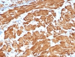 IHC staining of FFPE human uterus tissue with Actin (clone ACTA2/1614R). HIER: boil tissue sections in pH 9 10mM Tris with 1mM EDTA for 20 min and allow to cool before testing.