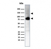 CAD Antibody / Caldesmon CALD1 Actin Cytoskeleton Organization Antibody. Western blot analysis of Caldesmon (CALD1) in human ovary tissue lysate. Lane 1: human ovary tissue lysate. A band is detected at approximately 70-80 kDa, consistent with the predicted molecular weight of Caldesmon / CALD1 and representing the lower molecular weight non-muscle isoform. Additional higher molecular weight bands may be observed at approximately 120-150 kDa corresponding to the smooth muscle-associated h-caldesmon isoform. CALD1 is known to produce multiple isoforms with distinct migration patterns, and the observed banding profile reflects isoform-dependent differences associated with cytoskeletal organization in muscle and non-muscle cells.