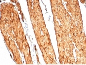 CAD Antibody / Caldesmon CALD1 Actin Cytoskeleton Organization Antibody. Immunohistochemistry analysis of Caldesmon (CALD1) in human colon tissue. FFPE human colon stained with CAD Antibody, clone CALD1/7024R, demonstrates strong HRP-DAB brown cytoplasmic staining in smooth muscle cells of the muscularis layer. The staining highlights elongated, spindle-shaped cells with dense filamentous cytoplasmic signal consistent with organized actin cytoskeleton structures and contractile filament bundles. Surrounding epithelial and stromal compartments show minimal staining, supporting localization of CALD1 to cytoskeletal networks within smooth muscle cells. Heat-induced epitope retrieval was performed using Tris-EDTA buffer at pH 9.