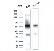 CD27 Antibody for WB. Western blot analysis of CD27 / TNFRSF7 expression in human B-cell lymphoma cell lines using CD27 Antibody. Lane 1: Raji cell lysate, Lane 2: Ramos cell lysate. A band is detected at approximately 50â60 kDa, consistent with glycosylated CD27, noting a lower predicted molecular weight of approximately 29 kDa for the core protein. Additional lower molecular weight signal may reflect unmodified or partially processed forms of CD27. The presence of CD27 signal in both Raji and Ramos cells aligns with known expression in B-cell lineage populations.