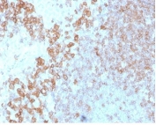 Immunohistochemistry analysis of CD27 Antibody Protein Microarray Validated in human tonsil tissue. FFPE human tonsil demonstrates membranous HRP-DAB brown staining in scattered lymphoid cells within interfollicular and paracortical regions, consistent with CD27/TNFRSF7 expression on activated and memory lymphocytes, while adjacent areas show lower staining intensity. Antigen retrieval was performed by boiling tissue sections in pH 9 10mM Tris with 1mM EDTA for 20 minutes followed by cooling prior to incubation with CD27 antibody (clone LPFS2/4178).