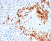 CD38 Antibody human tonsil tissue IHC. Immunohistochemistry analysis of CD38 expression in FFPE human tonsil tissue using CD38 antibody clone CD38/7017R. Strong membranous and cytoplasmic HRP-DAB brown staining highlights plasma cells and activated lymphocytes within interfollicular regions and surrounding germinal centers, consistent with a hematologic malignancy marker pattern for identifying lymphoid cell populations. The staining demonstrates dense immune cell distribution with clear contrast against predominantly negative background lymphocytes. Negative control inset: PBS was used in place of the primary antibody to control for secondary antibody binding. HIER was performed by boiling tissue sections in pH 9 10 mM Tris with 1 mM EDTA for 20 minutes followed by cooling prior to antibody incubation.