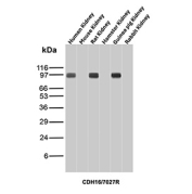 Cadherin 16 Antibody Multi-Species Kidney WB. Western blot analysis of Cadherin-16 / CDH16 expression across kidney tissue lysates from multiple species using Cadherin 16 antibody clone CDH16/7027R. Lane 1: human kidney lysate, Lane 2: mouse kidney lysate, Lane 3: rat kidney lysate, Lane 4: hamster kidney lysate, Lane 5: guinea pig kidney lysate, Lane 6: rabbit kidney lysate. Bands are detected at approximately 95-110 kDa in human, rat, and hamster kidney lysates, consistent with the predicted molecular weight of Cadherin-16 (CDH16), with the slightly higher apparent migration reflecting glycosylation of this kidney-restricted adhesion protein. Reduced or minimal signal is observed in mouse, guinea pig, and rabbit samples under these conditions, indicating species-dependent detection while maintaining strong reactivity in selected mammalian kidney tissues.