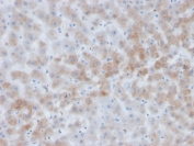 AACT Antibody for IHC Human Liver Tissue. Immunohistochemistry of Alpha-1-antichymotrypsin / SERPINA3 in FFPE human liver tissue using a mouse monoclonal AACT antibody, clone SERPINA3/4184. Strong HRP-DAB brown cytoplasmic staining is observed in hepatocytes, consistent with the secretory nature of this acute phase protein, while nuclei are counterstained blue. The staining pattern highlights widespread hepatocellular expression with minimal background signal. Heat induced epitope retrieval was performed by boiling sections in pH 9 10 mM Tris with 1 mM EDTA for 20 min followed by cooling before staining.