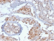 GCSAM Antibody Testis IHC. Immunohistochemistry analysis of FFPE human testis tissue stained with GCSAM Antibody demonstrates cytoplasmic and focal nuclear HRP-DAB brown staining within scattered immune-associated and germinal center-related cellular populations. This germinal center signaling antibody highlights GCSAM / HGAL-associated lymphoid differentiation pathways and germinal center-associated immune signaling biology. HIER: boil tissue sections in pH 9 10mM Tris with 1mM EDTA for 20 min and allow to cool before testing.