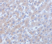 Alpha-1-Antichymotrypsin Antibody Human Liver Tissue IHC. Immunohistochemistry staining of FFPE human liver tissue with Alpha-1-Antichymotrypsin antibody (clone SERPINA3/4185). HIER: boil tissue sections in pH 9 10mM Tris with 1mM EDTA for 20 min and allow to cool before testing.