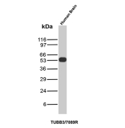 Beta Tubulin Antibody Human Brain Tissue WB. Western blot analysis of Beta III tubulin (TUBB3) expression in human brain tissue lysate using Beta Tubulin antibody clone TUBB3/7089R. Lane 1: human brain lysate. A band is detected at approximately 50â55 kDa, consistent with the predicted molecular weight of TUBB3, supporting reliable detection in neural samples.