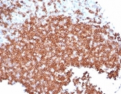 CD22 Antibody Tonsil B-Cell Staining. Immunohistochemistry analysis of CD22/Siglec-2 expression in FFPE human tonsil tissue using CD22 Antibody / B Cell Activation Modulation Antibody clone rBLCAM/6749. Strong HRP-DAB brown membranous and cytoplasmic staining is observed in germinal center and surrounding B cell zones, highlighting activated and differentiating B lymphocytes within lymphoid follicles, while adjacent stromal and non-lymphoid cells remain largely negative. The staining pattern reflects CD22 involvement in modulation of B cell activation and immune response dynamics and supports use of this CD22 antibody for immunohistochemistry-based evaluation of functional B cell states in lymphoid tissues. Heat-induced epitope retrieval was performed in pH 9 Tris-EDTA buffer for 20 minutes followed by cooling prior to antibody incubation.