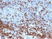 CD3e Antibody. Immunohistochemistry analysis of CD3 Epsilon / CD3E antibody in FFPE human tonsil tissue using CD3e Antibody / T Cell Receptor Signaling Marker Antibody with Clone C3e/4652R. Strong HRP-DAB brown membranous and cytoplasmic staining is observed in T lymphocytes within interfollicular and paracortical regions, consistent with T-cell zone distribution, while surrounding non-lymphoid cells show minimal background. The staining highlights CD3 epsilon as a key component of T cell receptor signaling within lymphoid tissue architecture. Heat-induced epitope retrieval was performed by boiling tissue sections in pH 9 10 mM Tris with 1 mM EDTA for 20 minutes followed by cooling prior to antibody incubation.