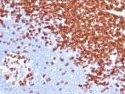 CD3e Antibody. Immunohistochemistry analysis of CD3 Epsilon / CD3E antibody in FFPE human lymph node tissue using CD3e Antibody / T Cell Receptor Signaling Marker Antibody with Clone C3e/4652R. Strong HRP-DAB brown membranous and cytoplasmic staining is observed in T lymphocytes within paracortical regions, consistent with T-cell zone localization, while surrounding non-lymphoid cells show minimal background. The staining highlights CD3 epsilon as a key component of T cell receptor signaling within lymphoid tissue architecture. Heat-induced epitope retrieval was performed by boiling tissue sections in pH 9 10 mM Tris with 1 mM EDTA for 20 minutes followed by cooling prior to antibody incubation.