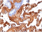 Fibronectin 1 Antibody Human Lung IHC. Immunohistochemistry analysis of FFPE human lung tissue stained with clone FN1/3569. Extracellular and pericellular HRP-DAB brown staining is observed within stromal connective tissue and alveolar-associated matrix structures, consistent with expression of Fibronectin 1 / FN1, a major extracellular matrix glycoprotein involved in tissue remodeling, cellular adhesion, and stromal organization pathways. Surrounding epithelial cells show comparatively lower staining intensity. HIER: boil tissue sections in pH 9 10mM Tris with 1mM EDTA for 20 min and allow to cool before testing.