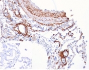 FGF21 Antibody Human Lung IHC. Immunohistochemistry analysis of FFPE human lung tissue stained with FGF21 Antibody / Metabolic Signaling Hormone Antibody clone FGF21/4343 demonstrates distinct cytoplasmic and membranous HRP-DAB brown staining within epithelial cell populations lining bronchial and alveolar-associated structures, consistent with the role of Fibroblast growth factor 21 / FGF21 in metabolic adaptation, endocrine signaling, and tissue-associated energy homeostasis pathways. The negative control inset using PBS in place of primary antibody demonstrates minimal background secondary antibody binding. HIER: boil tissue sections in pH 9 10mM Tris with 1mM EDTA for 20 min and allow to cool before testing.