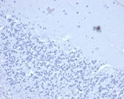 Negative control: IHC staining of FFPE human brain tissue with recombinant CD2 antibody (clone LFA2/3417R) at 2ug/ml in PBS for 30min RT. HIER: boil tissue sections in pH 9 10mM Tris with 1mM EDTA for 20 min and allow to cool before testing.