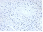 Negative Control ALPP Antibody Testis IHC. Immunohistochemistry analysis of FFPE human testis tissue stained with ALPP Antibody (clone rALP/870) demonstrates minimal detectable HRP-DAB staining within seminiferous tubules and surrounding stromal compartments, supporting the restricted physiologic expression profile of placental alkaline phosphatase / ALPP outside placental and trophoblast-associated tissues. This placental marker antibody shows low background reactivity in normal testicular tissue. Antibody concentration: 2ug/ml in PBS for 30 min at RT. HIER: boil tissue sections in pH 9 10mM Tris with 1mM EDTA for 20 min and allow to cool before testing.