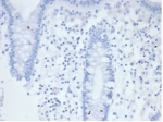 Negative Control ALPP Antibody Colon IHC. Immunohistochemistry analysis of FFPE human colon tissue stained with ALPP Antibody clone rALP/870 demonstrates minimal detectable HRP-DAB staining within colonic epithelial and stromal compartments, supporting the restricted placental-associated expression profile of placental alkaline phosphatase / ALPP in non-trophoblastic tissues. This placental marker antibody shows low background reactivity in normal gastrointestinal epithelium. Antibody concentration: 2ug/ml in PBS for 30 min at RT. HIER: boil tissue sections in pH 9 10mM Tris with 1mM EDTA for 20 min and allow to cool before testing.