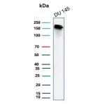 Recombinant MSH6 Antibody MSH6/7065R in Human DU145 Prostate Cancer Cells WB. Western blot testing of Recombinant MSH6 Antibody, clone MSH6/7065R, in human DU145 prostate cancer cell lysate. A prominent band is detected at approximately 160 kDa, consistent with the predicted molecular weight of MSH6. This Recombinant MSH6 Antibody demonstrates detection of the DNA mismatch repair protein in human prostate cancer cells.
